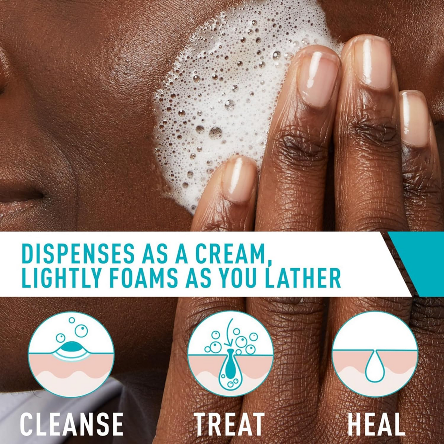 Acne Foaming Cleanser