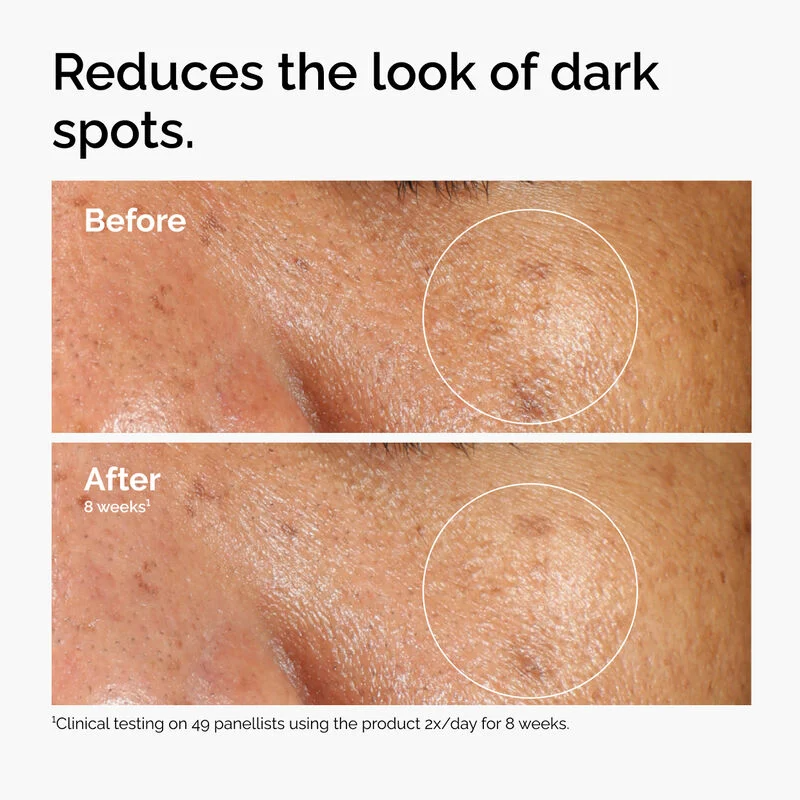 The Ordinary Alpha Arbutin 2% + HA 30mL