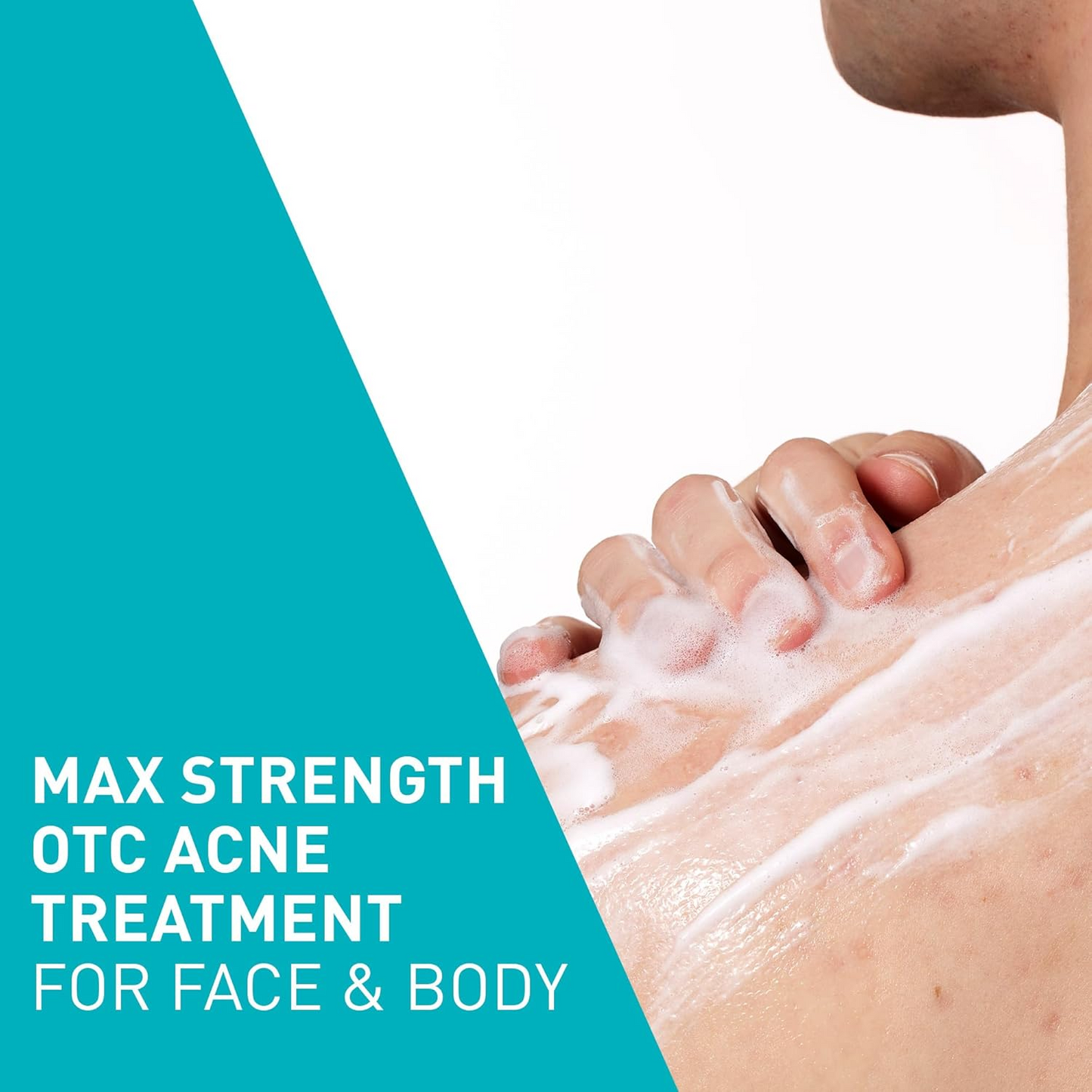 Acne Foaming Cream Wash